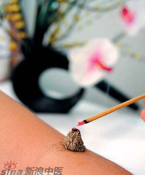 節(jié)氣灸” 冬至，你灸了嗎？