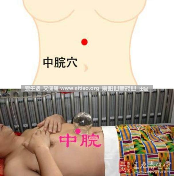 中脘穴位于腹部正中線，臍上4寸的位置上。每天艾灸10-15分鐘，能有效緩解胃部不適的癥狀，同時有助于祛濕。